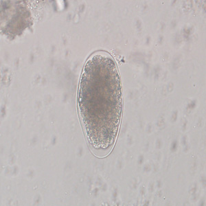 File:Trichostrongylus egg wtmt IN1.jpg