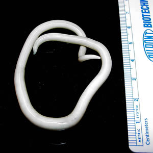 Adult female A. lumbricoides. Adapted from CDC