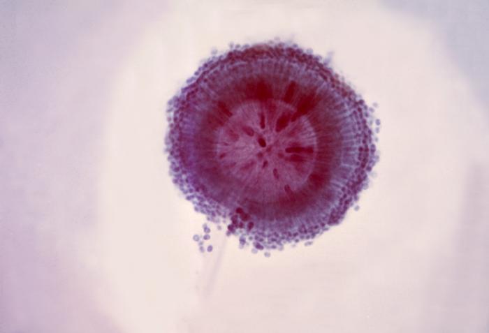 Conidial head of an Aspergillus niger fungal organism showing a double row of sterigmata. From Public Health Image Library (PHIL). [2]