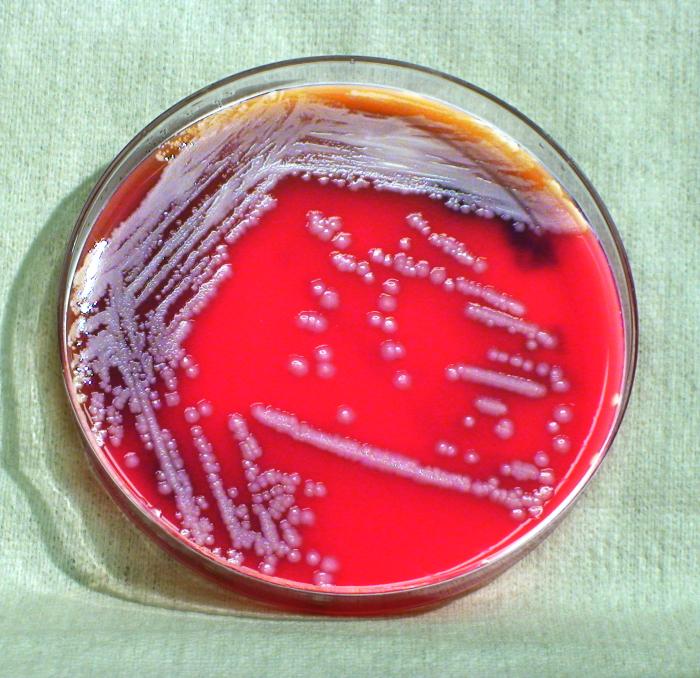 Gram-negative Burkholderia thailandensis bacteria, which was grown on a medium of sheep’s blood agar (SBA) 48hrs. From Public Health Image Library (PHIL). [5]