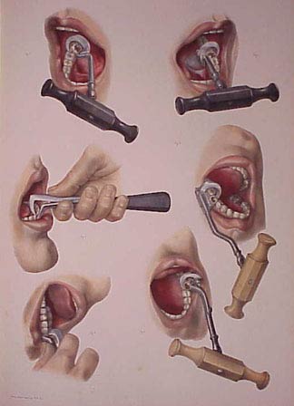 Dentalkeyusage.jpg