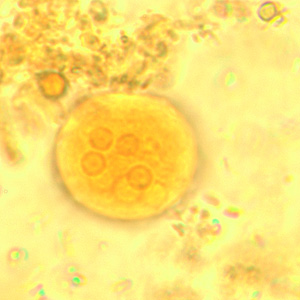 Cyst of E. coli in a concentrated wet mount stained with iodine. Seven nuclei are visible in this focal plane