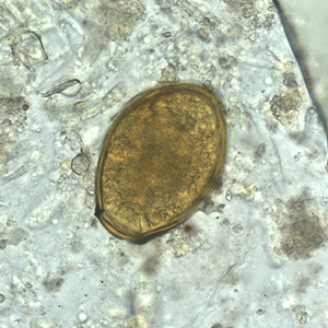 Egg of P. westermani in an unstained wet mount. Adapted from CDC
