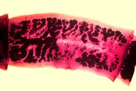 Mature proglottid of T. solium, stained with carmine. Note the number of primary uterine branches (<13). Adapted from CDC