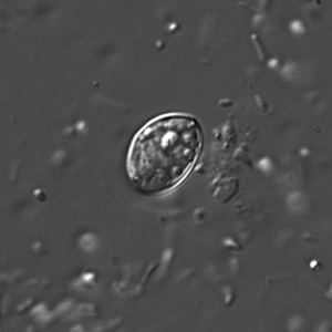 Individual sporocyst of Sarcocystis sp. in a wet mount viewed under DIC microscopy, magnification 400x. Adapted from CDC