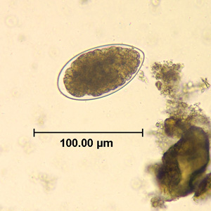 Egg of Trichostrongylus sp. in an unstained wet mount of stool. Adapted from CDC
