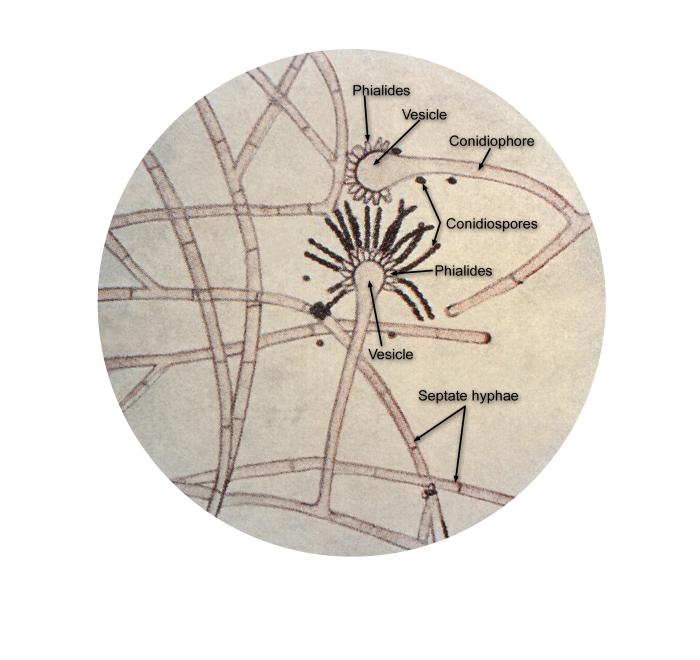 Under a magnification of 125X, this illustration depicts the ultrastructural details found in the common mold, Aspergillus including the organism’s septate hyphae, conidiophores, which support the apparatus. From Public Health Image Library (PHIL). [2]