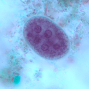 Mature cyst of E. coli, stained with trichrome. In this specimen, at least five nuclei are visible in the shown focal plane. Adapted from CDC