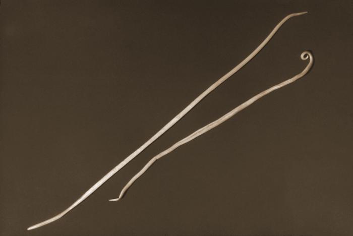 Depicted in this 1960 photograph were two Ascaris lumbricoides nematods, i.e., roundworms. The larger of the two was the female of the species, while the normally smaller male was on the right. Adult female worms can grow over 12 inches in length. From Public Health Image Library (PHIL). [6]