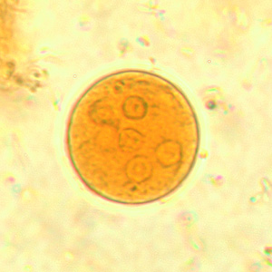 Cyst of E. coli in a concentrated wet mount stained with iodine. Seven nuclei are visible in this focal plane. Adapted from CDC