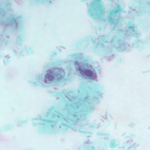 Two trophozoites of P. hominis in a stool specimen, stained with trichrome. Adapted from CDC