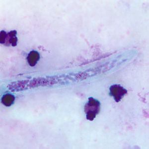 Close-up of the anterior end of the worm in Figure 3. Adapted from CDC