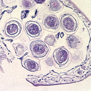 Higher magnification of eggs within the proglottid in Figure 1, taken at 400x. Adapted from CDC