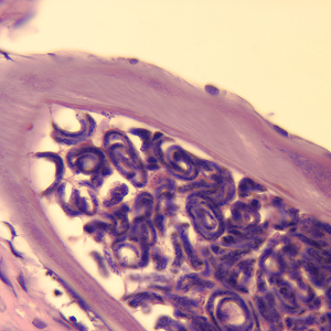 Cross-section of an adult female O. volvulus, stained with H&E. Note the presence of many microfilariae within the uterus. Adapted from CDC