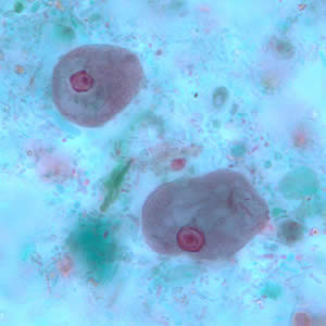 Trophozoites of E. coli stained with trichrome. Adapted from CDC