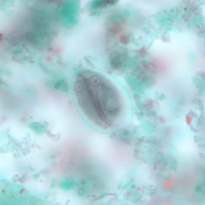G. duodenalis cyst stained with trichrome. Sometimes the cytoplasm of the cyst may retract from the cell wall. Adapted from CDC