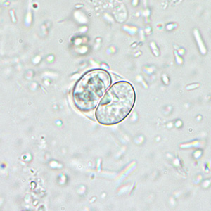 Sporulated oocyst of Sarcocystis sp. in unstained wet mounts, magnification 400x. Adapted from CDC