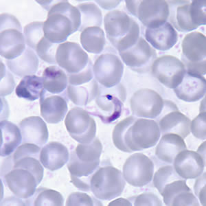 T. cruzi trypomastigote in a thin blood smear stained with Giemsa. Note the typical C-shape of the trypomastigote that characterizes T. cruzi in fixed blood smears. Adapted from CDC