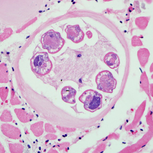Trichinella larva in tongue muscle of a rat, stained with hematoxylin and eosin (H&E). Image was captured at 400x magnification. Adapted from CDC