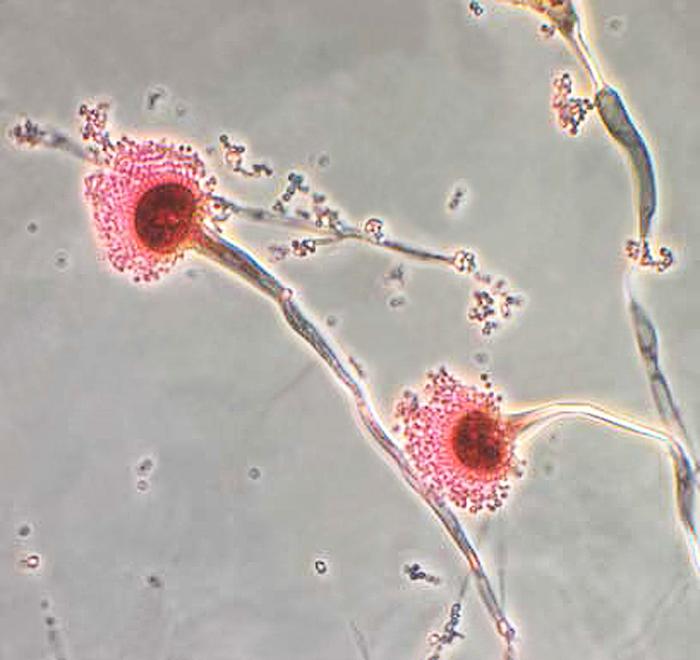 This photomicrograph reveals some of the ultrastructural morphology displayed by the fungal organism Aspergillus fumigatus. Of particular importance is the filamentous conidiophore, which ends in a bulbous, spheroid-shaped vesicle. From Public Health Image Library (PHIL). [1]