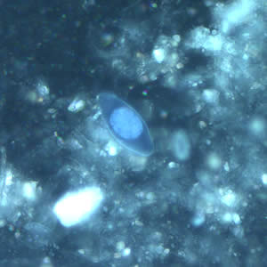 Same oocyst as in Figures 1 and 3 but viewed under ultraviolet (UV) fluorescent micrscopy. Adapted from CDC