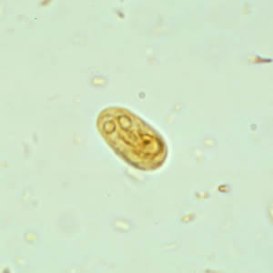 G. duodenalis cyst in a wet mount stained with iodine. Adapted from CDC