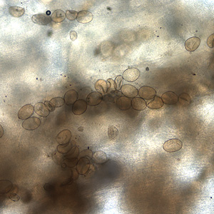 Eggs of D. latum within a proglottid. Image courtesy of the Florida State Public Health Laboratory. Adapted from CDC