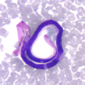 Microfilaria of B. malayi in a thin blood smear, stained with Giemsa. Adapted from CDC