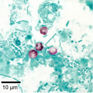 Cryptosporidium parvum oocysts stained with modified acid-fast. Against a blue-green background, the oocysts stand out in a bright red stain. Adapted from CDC