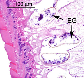 Higher magnification of the specimen in Figures 1-3. Shown here are eggs (EG) within the size range forEchinostoma spp. (roughly 100 micrometers in length, taking into account they are sections and may not be cut in a perfect horizontal plane). Adapted from CDC