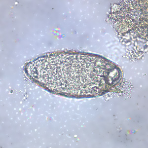 Adults of S. mansoni. The thin female resides in the gynecophoral canal of the thicker male. Note the tuberculate exterior of the male. Adapted from CDC