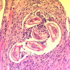 Cross-sections of larvae of B. columnaris in muscle of a laboratory-infected mouse. The larval morphology and microscopic manifestations would be similar with B. procyonis in human tissue. Image taken at 400x magnification. Adapted from CDC