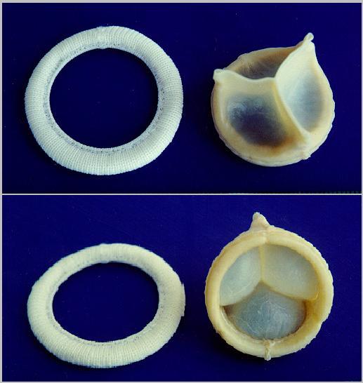 A replaceable model of Cardiac Biological Valve Prosthesis.