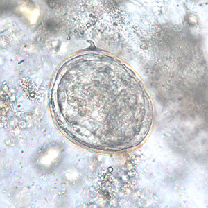 Egg of S. japonicum in an unstained wet mount of stool. Adapted from CDC