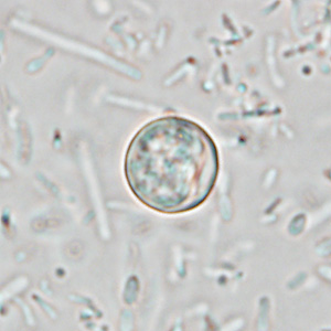 Oocyst of C. cayetanensis in an unstained wet mount of stool. Image taken at 1000x magnification. Adapted from CDC