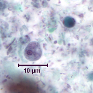 trophozoite of E. hartmanni stained with trichrome. In the upper-right of the image is a cyst-like body of Blastocystis hominis