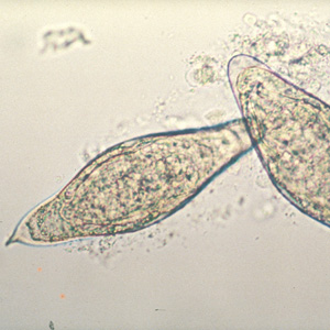Egg of S. intercalatum in a wet mount. Adapted from CDC