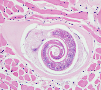 Trichinella larva in tongue muscle of a rat, stained with hematoxylin and eosin (H&E). Image was captured at 400x magnification. Adapted from CDC