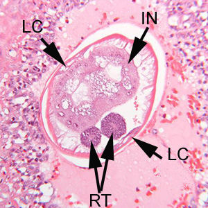 Higher magnification of the specimen in Figure 3. Shown here are the thick, multinucleate intestine (IN), reproductive tubes (RT), and lateral chords (LC). Adapted from CDC
