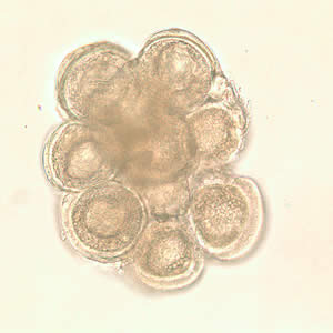 D. caninum egg packet in wet mount. Adapted from CDC
