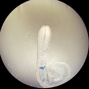 Sparganum removed from the chest wall of a patient. The worm measured about 70 mm long. Images from a specimen courtesy of the Oklahoma State Department of Health. Adapted from CDC