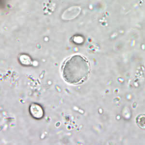 B. hominis cyst-like form in a wet mount, unstained. Adapted from CDC