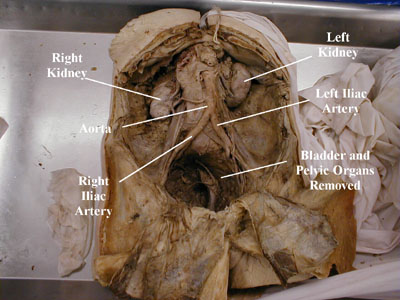 Gross Retroperitoneal Anatomy