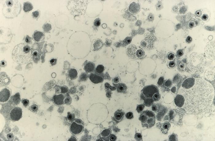 Transmission electron micrograph (TEM) depicts numbers of cytomegalovirus virions that were present in an unknown tissue sample (200X Mag). From Public Health Image Library (PHIL). [1]
