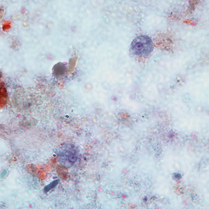 Two trophozoites of E. hartmanni stained with trichrome. Adapted from CDC