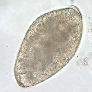 Higher magnification (400x) of the egg in Figure 4. Adapted from CDC