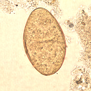 Egg of F. buski in a unstained wet mount. Adapted from CDC
