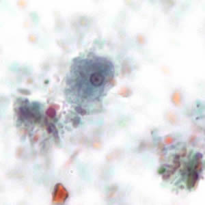 Trophozoite of E. hartmanni stained with trichrome. Adapted from CDC