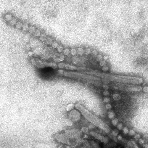 File:Electron Micrograph Images of H7N9 Virus from China.jpg