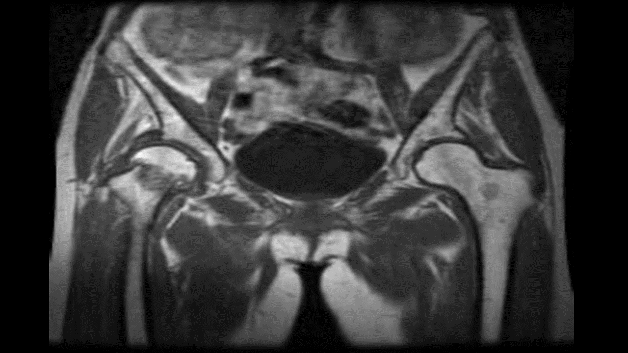 File:Neck MRI.gif